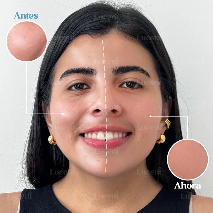 Candy Bella® | Gel prensado para control de grasa facial - TodoBacano
